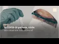 What Do Ground Glass Opacities Mean in Lung Scans of COVID-19 Patients