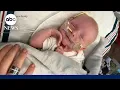 Doctors saved baby s life with gene fix for deadly rare disease