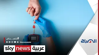 في اليوم العالمي للسكري لماذا لا يحصل الملايين على الرعاية اللازمة الصباح 