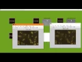 Automated Malaria Cell Counter using Hough Transform matlab projects