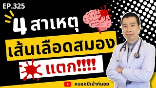 การสูบบุหรี่มีผลต่อเส้นเลือดในสมองอย่างไร