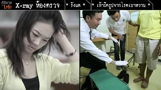 รังแครคืออะไร และมันเกิดจากสาเหตุใด