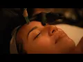 Just Relax - Microneedling