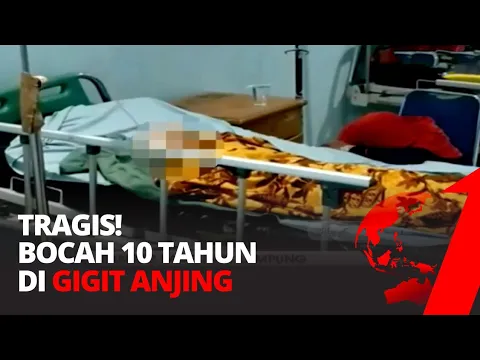 Tragis, Bocah 10 Tahun di Gigit Seekor Anjing Pabrik Saat Mengejar Layangan