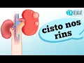 KIDNEY CYST What are they What are the characteristics of this type of problem