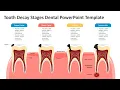 Tooth Decay Stages Dental PowerPoint Template Kridha Graphics