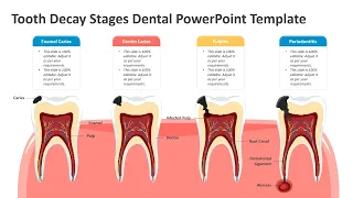 Tooth Decay Stages Dental PowerPoint Template Kridha Graphics