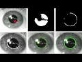 How Pupil Fitting Works in Eye Tracking Algorithms
