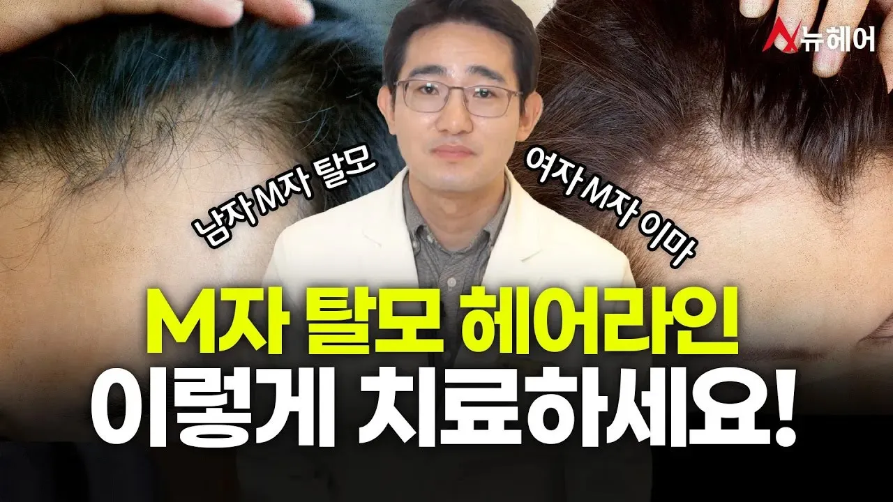 엠자탈모 엠자이마 헤어라인 이렇게 치료하세요ㅣ뉴헤어