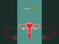 5 CAUSES OF BLEEDING AFTER SEX
