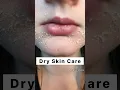 Download Lagu 🔥Dry skincare home remedies 💯| winter skincare| #shorts #dryskin #viral #ytshorts