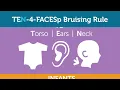 TEN-4-FACESp Bruising Rule