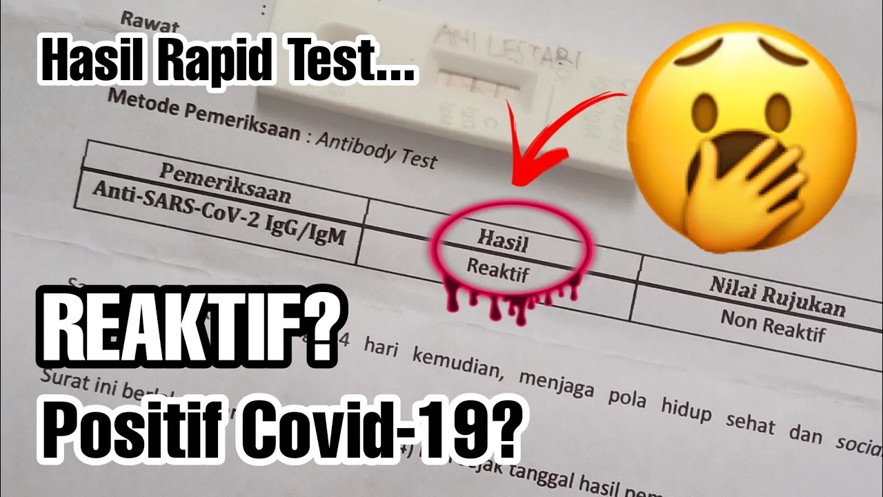 Uji Rapid Antigen COVID-19. 