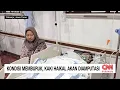 Download Lagu Kondisi Memburuk, Kaki Haikal Korban Ponpes Roboh Akan Diamputasi
