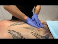 Lymphatic Massage AFTER MALE TUMMY TUCK AND BODY LIPOSUCTION West Hollywood CA Dr Jason Emer