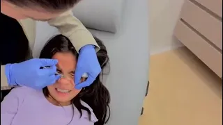 Así quedó Salomé después de su cirugía con láser.😱🥰♥️
