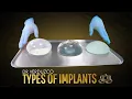 Conoce los Tipos de Implantes con Dr Sergio Verduzco - Vive Plastic Surgery
