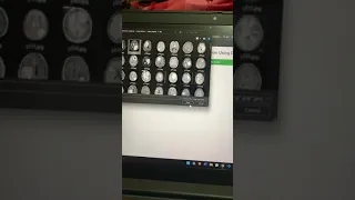 BRAIN TUMOR DETECTION USING DEEP LEARNING
