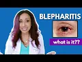 What Is Blepharitis Eye Doctor Explains