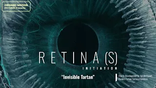 retina s initiation 7 14 