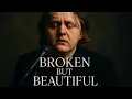Download Lagu Broken But Beautiful – Lewis Capaldi (Official Emotional Ballad) @EternaFM 