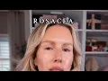 Download Lagu ROSACEA
