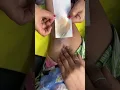 Very Hairy Teenage Indian Girl Gets Her Hairy Armpits Legs And Arms Waxed