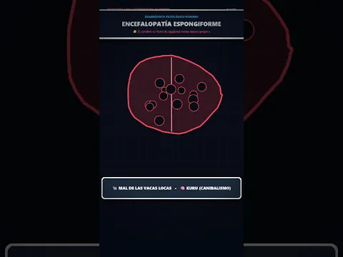 No es un virus ni una bacteria: La proteína inmortal que te come el cerebro 🥩🧟‍♂️