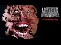 Download Lagu UNDEATH - DISPUTATIOUS MALIGNANCY (OFFICIAL VIDEO)