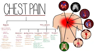 Approach to Chest Pain Made Easy