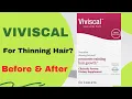 Viviscal Does It Work The Proof