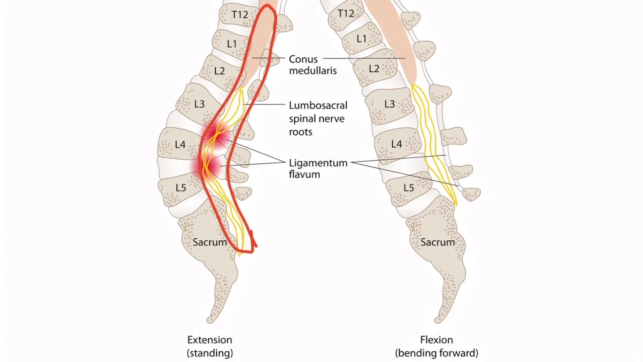 Differential Diagnosis II (Lumbar Spine Disease) Summer-2015-Edited Version. 