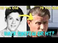 Sylvester Stallone Hair Transplant or Hair System Dr Nakatsui Responds
