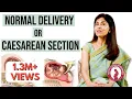 Normal Delivery Or Caesarean Section Dr Anjali Kumar Maitri