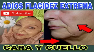 QUITA FLACIDEZ EXTREMA DE TU CARA Y CUELLO #flacidez #cuidadodelapiel