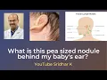 What is this pea like swelling behind my baby s ears Sridhar K