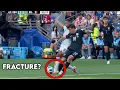 Christian Pulisic Broke His Leg vs Belgium Kind of - Doctor Explains