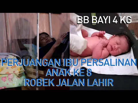 Download MP3 PERJUANGAN PERSALINAN ANAK KE 8 BERAT 4 KG | PERSALINAN POSISI MENERAN KESAMPING| ROBEK JALAN LAHIR