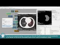 MeVisLab Tutorials - Contours