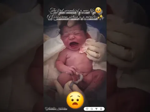 Baby Stops Crying in Mommy’s Loving Arms ❤️🥹 #Shorts #mom #baby #youtube #new #best