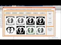 Lung Cancer Detection using Computer Aided System CAD
