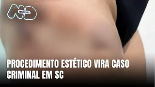 Modelo processa clínica de Jaraguá do Sul por procedimentos ilegais