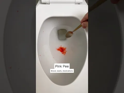 What color was your pee today? - Urine Color Guide