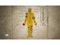 Acupuncture 101 Benefits and Procedure WebMD