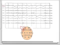 EEG - 101