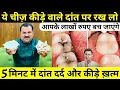Lagu एक बार में दांत का कीड़ा और दर्द बाहर निकालने का बेहतरीन उपाय - How To Get Rid Of Tooth Cavity
