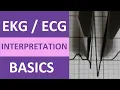 Interpretation Basics Nursing NCLEX QRS Complex P Wave T Wave PR Interval