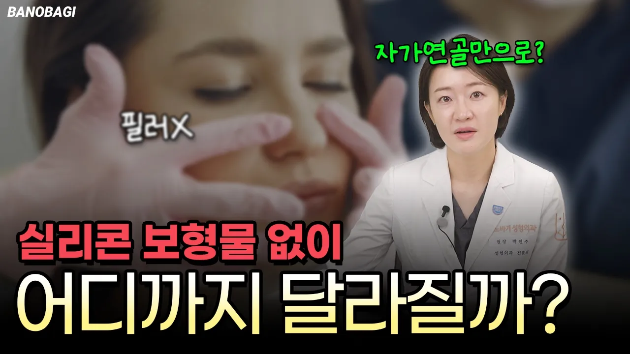 실리콘 없이도 코가 오똑해질까? 자가연골 코성형 케이스 리뷰🔥