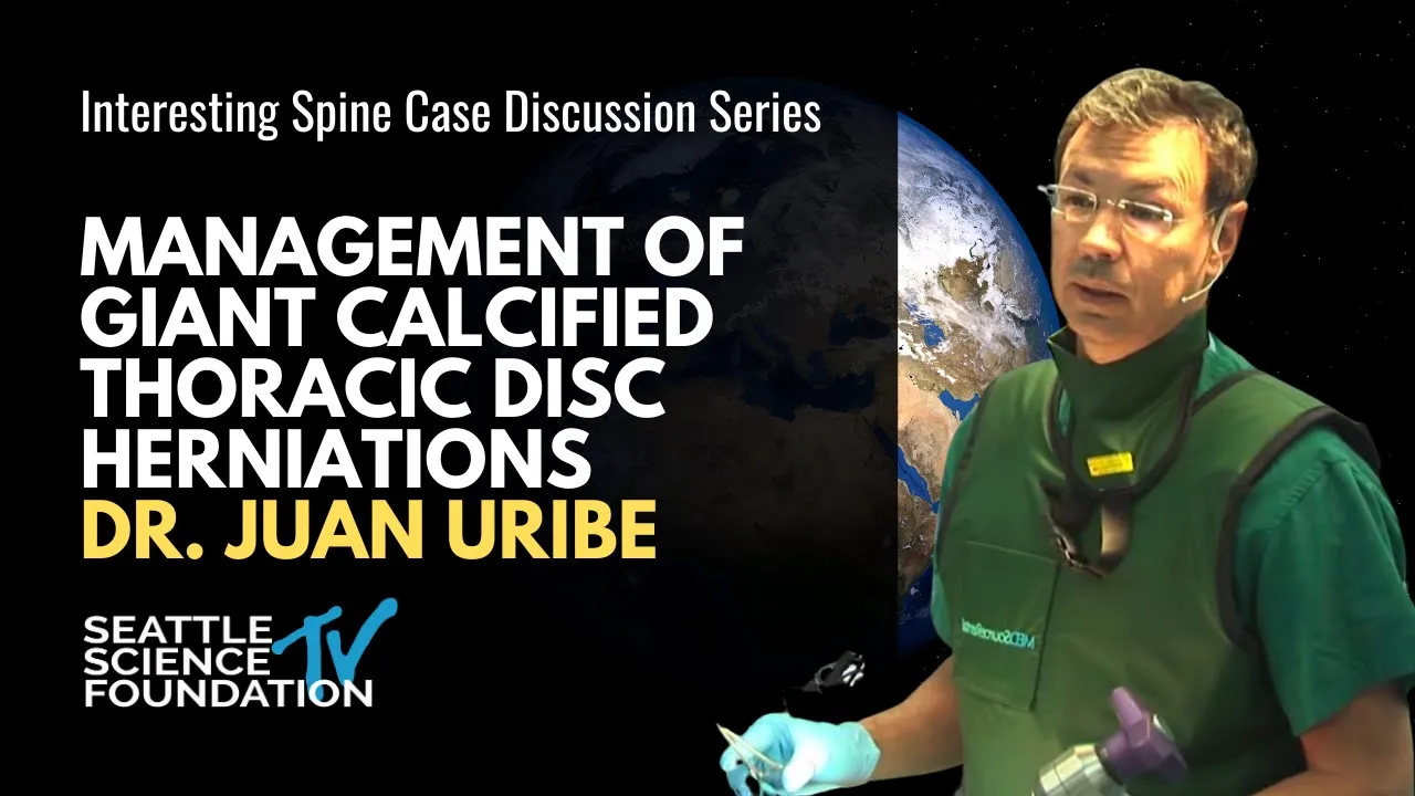 Lumbar Disc Herniations: Center for Spine and Orthopedics | Moderated by Dr. Michael Janssen. 