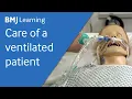 Care of a patient on a ventilator BMJ Learning